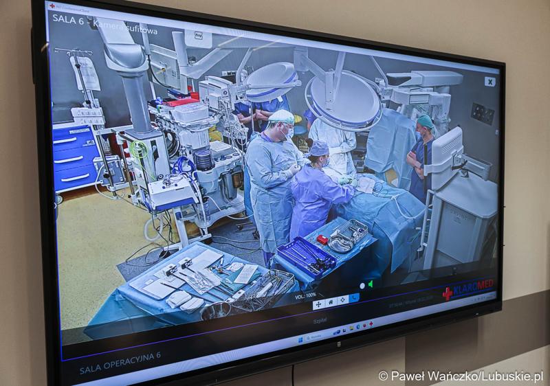 Pierwszy zabieg z użyciem robota operacyjnego da Vinci w Szpitalu Uniwersyteckim