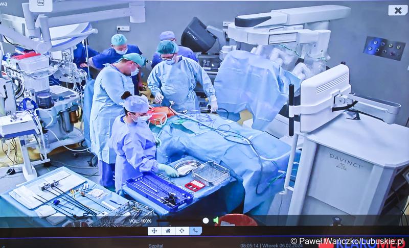 Pierwszy zabieg z użyciem robota operacyjnego da Vinci w Szpitalu Uniwersyteckim