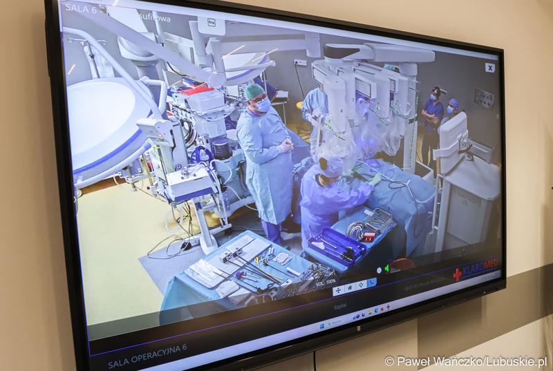 Pierwszy zabieg z użyciem robota operacyjnego da Vinci w Szpitalu Uniwersyteckim