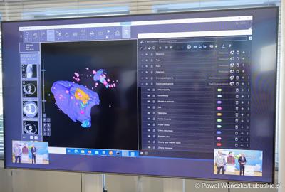 Monitor z prezentacją podczas konferencji prasowej dot. lubuskiego projektu wsparcia diagnostyki i medycyny systemami Sztucznej Inteligencji - MedBrain L 