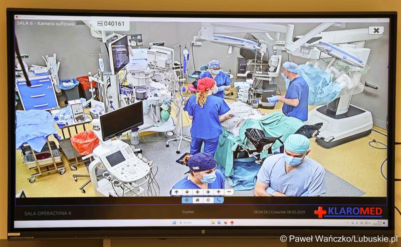 Monitor pokazujący obraz na żywo z operacji z wykorzystaniem robota da Vinci