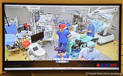 Monitor pokazujący obraz na żywo z operacji z wykorzystaniem robota da Vinci