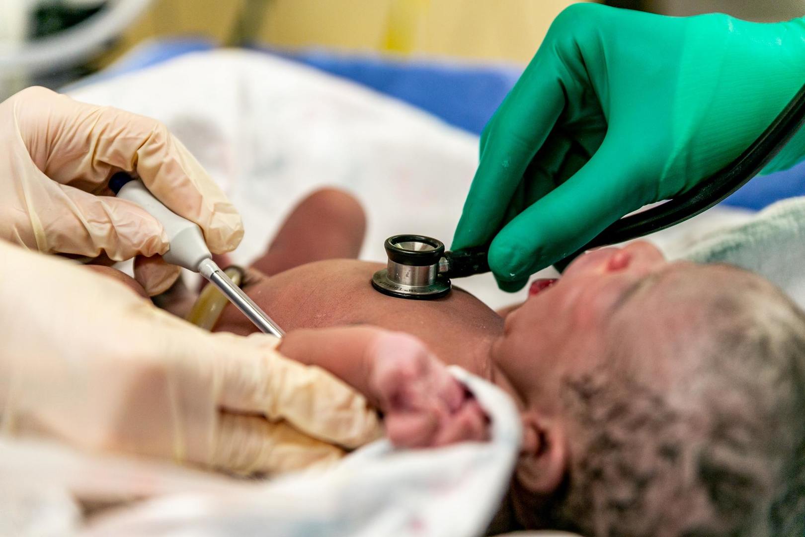 Na świecie wprowadza się badania przesiewowe wszystkich noworodków w kierunku SMA, tak aby móc rozpocząć leczenie natychmiast po wykryciu wady genetycznej, jeszcze zanim rozpocznie się śmierć neuronów i utrata funkcji przez mięśnie.