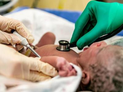 Na świecie wprowadza się badania przesiewowe wszystkich noworodków w kierunku SMA, tak aby móc rozpocząć leczenie natychmiast po wykryciu wady genetycznej, jeszcze zanim rozpocznie się śmierć neuronów i utrata funkcji przez mięśnie.